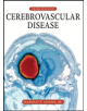 Principles of Cerebrovascular Disease - 9780071416535-thumb