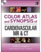 Color Atlas and Synopsis of Cardiovascular MR and CT (SET 2) - 9780071747349-thumb