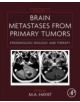 Brain Metastases from Primary Tumors - 9780128008966-thumb