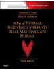 Atlas of Normal Roentgen Variants That May Simulate Disease - 9780323073554-thumb