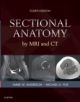 Sectional Anatomy by MRI and CT - 9780323394192-thumb