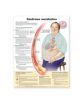 Metabolic Syndrome Anatomical Chart in Spanish (Sindrome metabolico) - 9780781773089-thumb