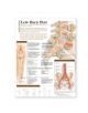 Understanding Low Back Pain Anatomical Chart - 9780781782425-thumb