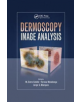Dermoscopy Image Analysis - 9781138892873-thumb
