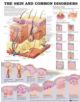 The Skin and Common Disorders Anatomical Chart - 9781587796135-thumb