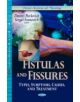 Fistulas & Fissures - 9781626180680-thumb