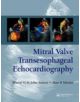 Mitral Valve Transesophageal Echocardiography - 9781841846088-thumb