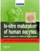 In Vitro Maturation of Human Oocytes - 9781842143322-thumb