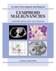 Lymphoid Malignancies - 9781904392675-thumb