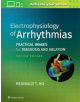 Electrophysiology of Arrhythmias - 9781975101107-thumb