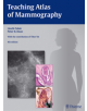 Teaching Atlas of Mammography - 9783136408049-thumb