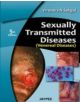 Sexually Transmitted Diseases (Venereal Diseases) - 9788184489545-thumb