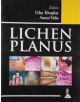 Lichen Planus - 9789350904572-thumb
