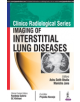 Clinico Radiological Series: Imaging of Interstitial Lung Diseases - 9789386322517-thumb