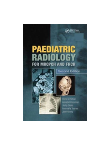 Paediatric Radiology for MRCPCH and FRCR, Second Edition