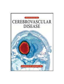 Principles of Cerebrovascular Disease - 9780071416535