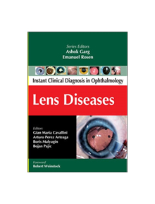 Lens Diseases - 9780071667210