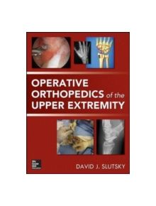 Operative Orthopedics of the Upper Extremity - 9780071789271