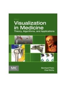 Visual Computing for Medicine - 9780124158733