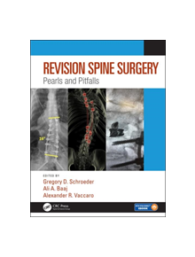 Revision Spine Surgery - 9781498773829