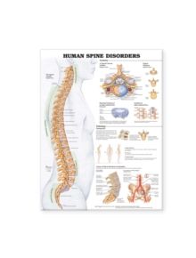 Human Spine Disorders Anatomical Chart - 9781587793998