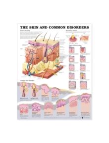 The Skin and Common Disorders Anatomical Chart - 9781587796128