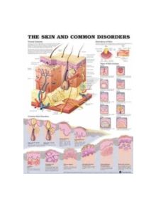 The Skin and Common Disorders Anatomical Chart - 9781587796135