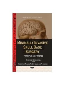 Minimally Invasive Skull Base Surgery - 9781628085679