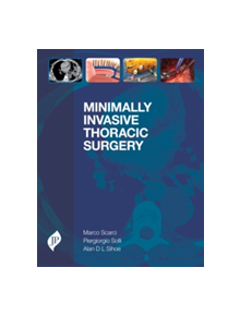 Minimally Invasive Thoracic Surgery - 9781909836402