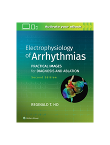 Electrophysiology of Arrhythmias - 9781975101107
