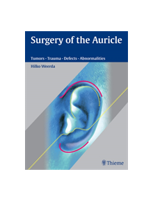 Surgery of the Auricle - 9783131394118