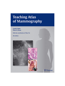 Teaching Atlas of Mammography - 9783136408049