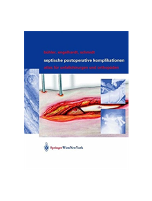 Septische postoperative Komplikationen - 9783709172926