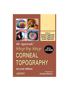 Dr Agarwal's Step by Step (R) Corneal Topography - 9788180617508
