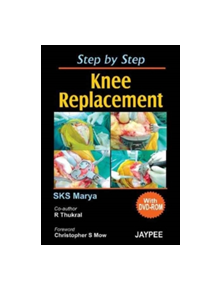 Step by Step Knee Replacement - 9788180619229