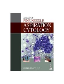 Atlas of Fine Needle Aspiration Cytology - 9789351521112