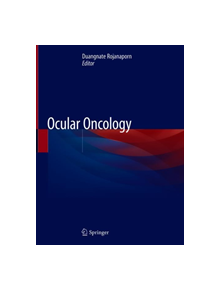 Ocular Oncology - 9789811323355